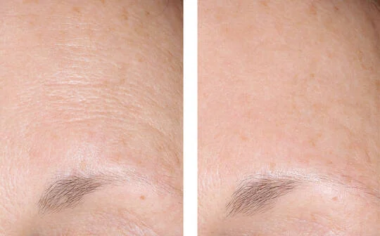 SkinBetter Science® AlphaRet® Overnight Cream