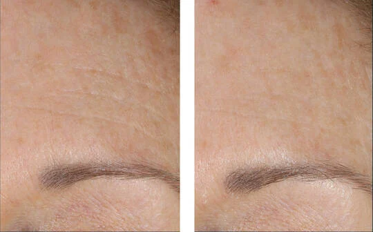 SkinBetter Science® AlphaRet® Overnight Cream