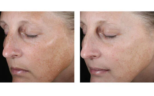 SkinBetter Science® AlphaRet® Overnight Cream