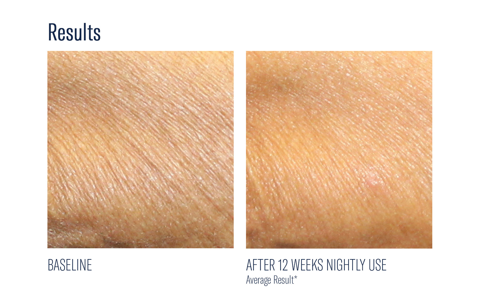 SkinBetter Science® AlphaRet® Overnight Body Cream
