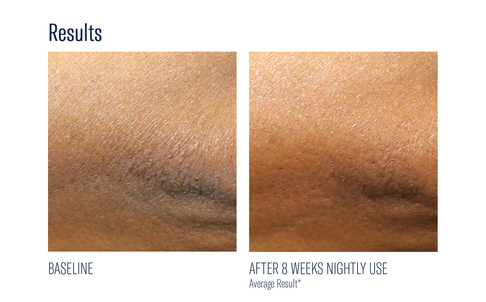 SkinBetter Science® AlphaRet® Overnight Body Cream