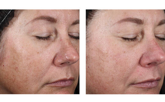SkinBetter Science® Alto Advanced Defense & Repair Serum