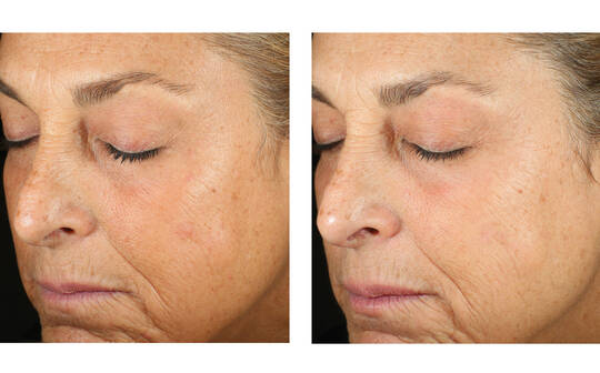 SkinBetter Science® Alto Advanced Defense & Repair Serum