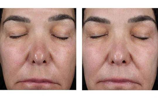 SkinBetter Science® Alto Advanced Defense & Repair Serum