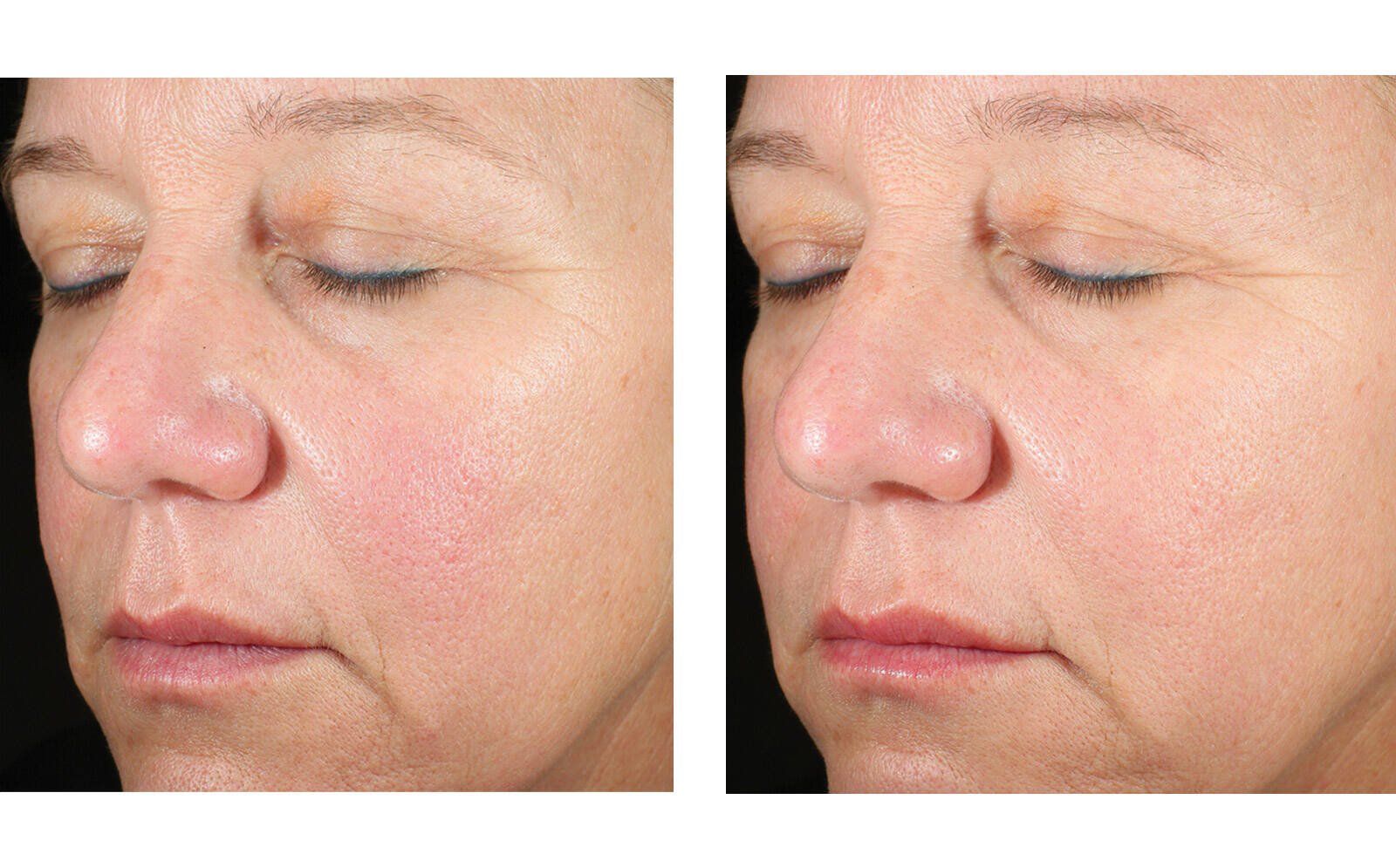 SkinBetter Science® Alto Advanced Defense & Repair Serum