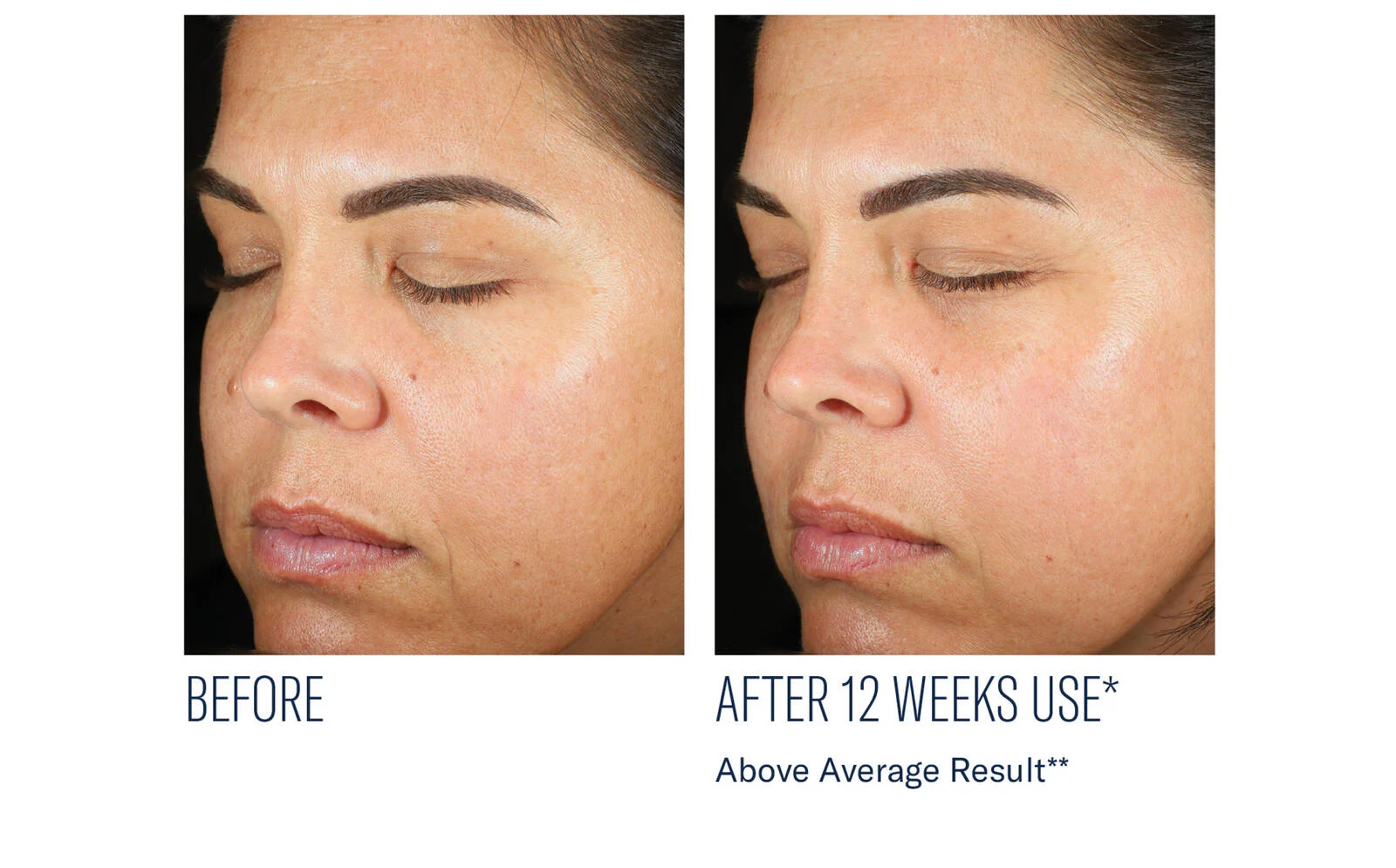 SkinBetter Science® Even Intensive Skin Tone Correcting Serum