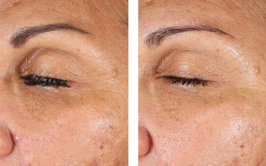 SkinBetter Science® EyeMax Cream