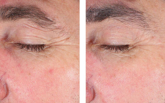 SkinBetter Science® EyeMax Cream