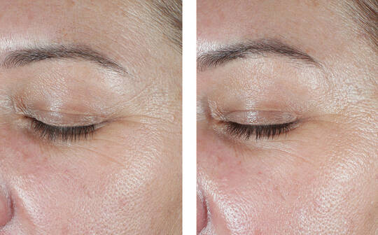 SkinBetter Science® EyeMax Cream