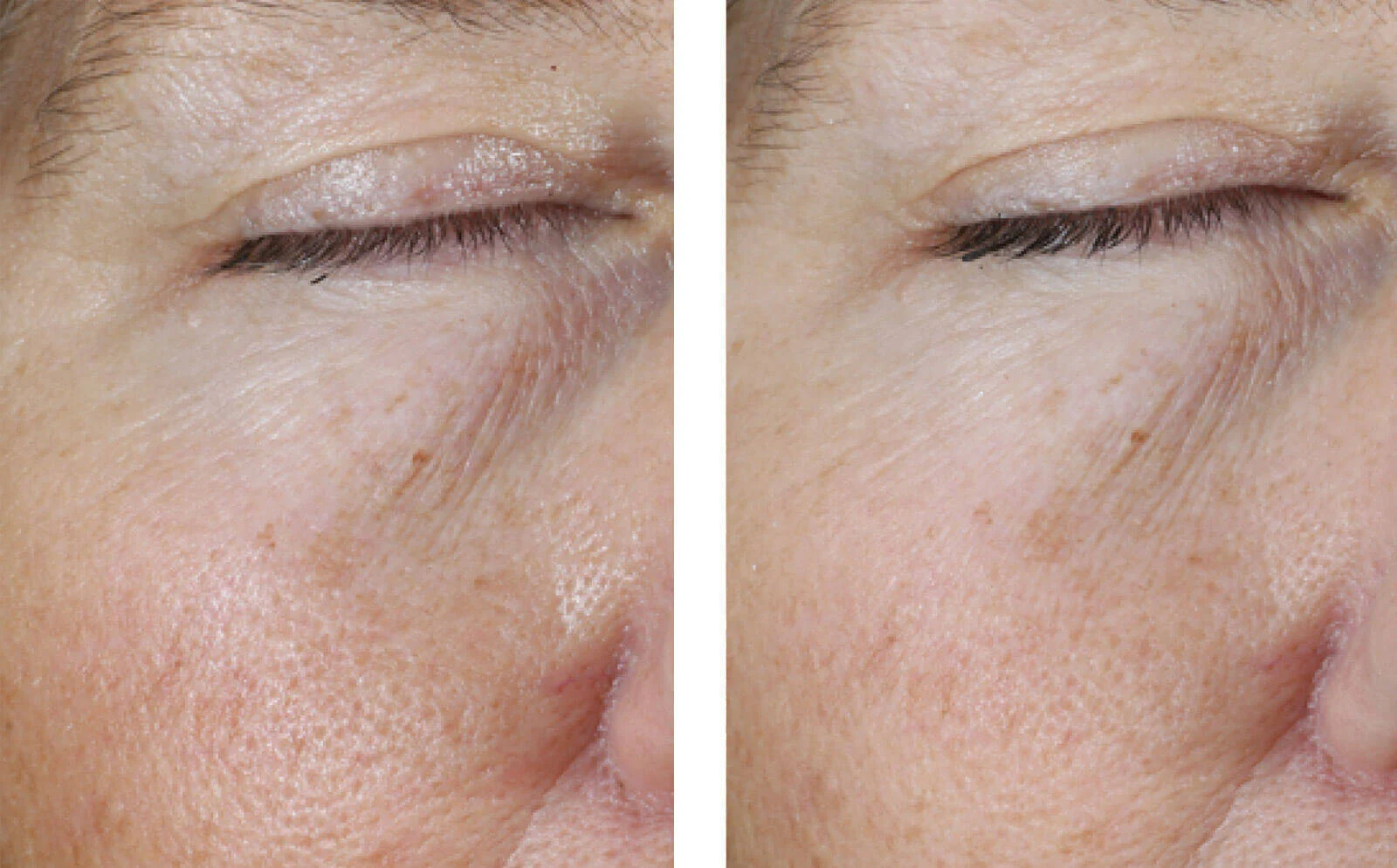 SkinBetter Science® Instant Effect Eye Gel
