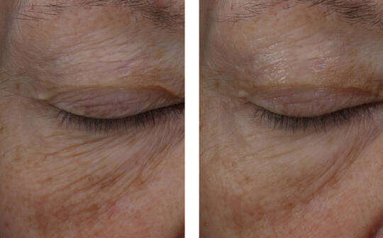 SkinBetter Science® InterFuse® Treatment Cream EYE