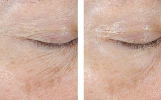 SkinBetter Science® InterFuse® Treatment Cream EYE