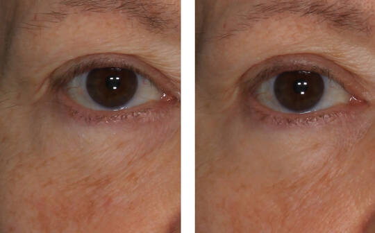 SkinBetter Science® InterFuse® Treatment Cream EYE
