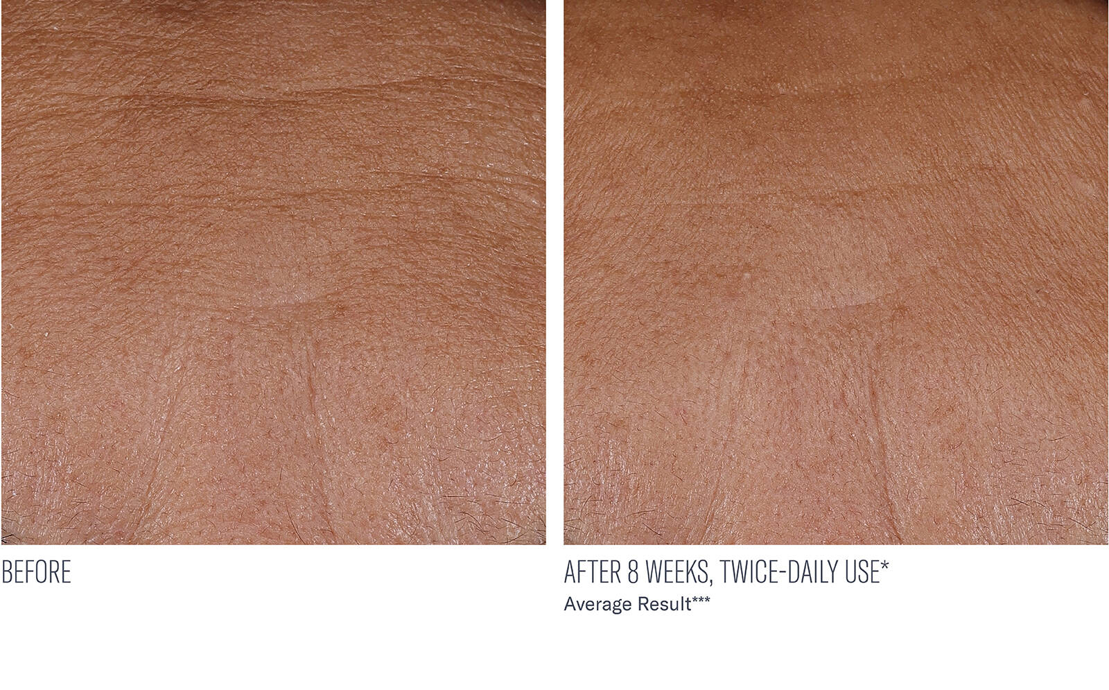 SkinBetter Science® InterFuse® Treatment Cream FACE & NECK