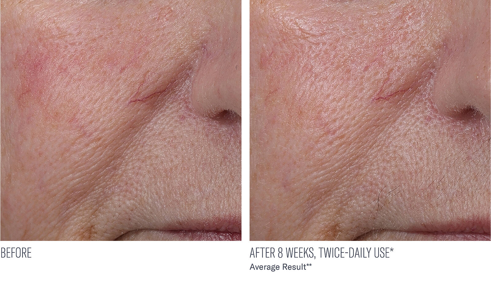 SkinBetter Science® InterFuse® Treatment Cream FACE & NECK