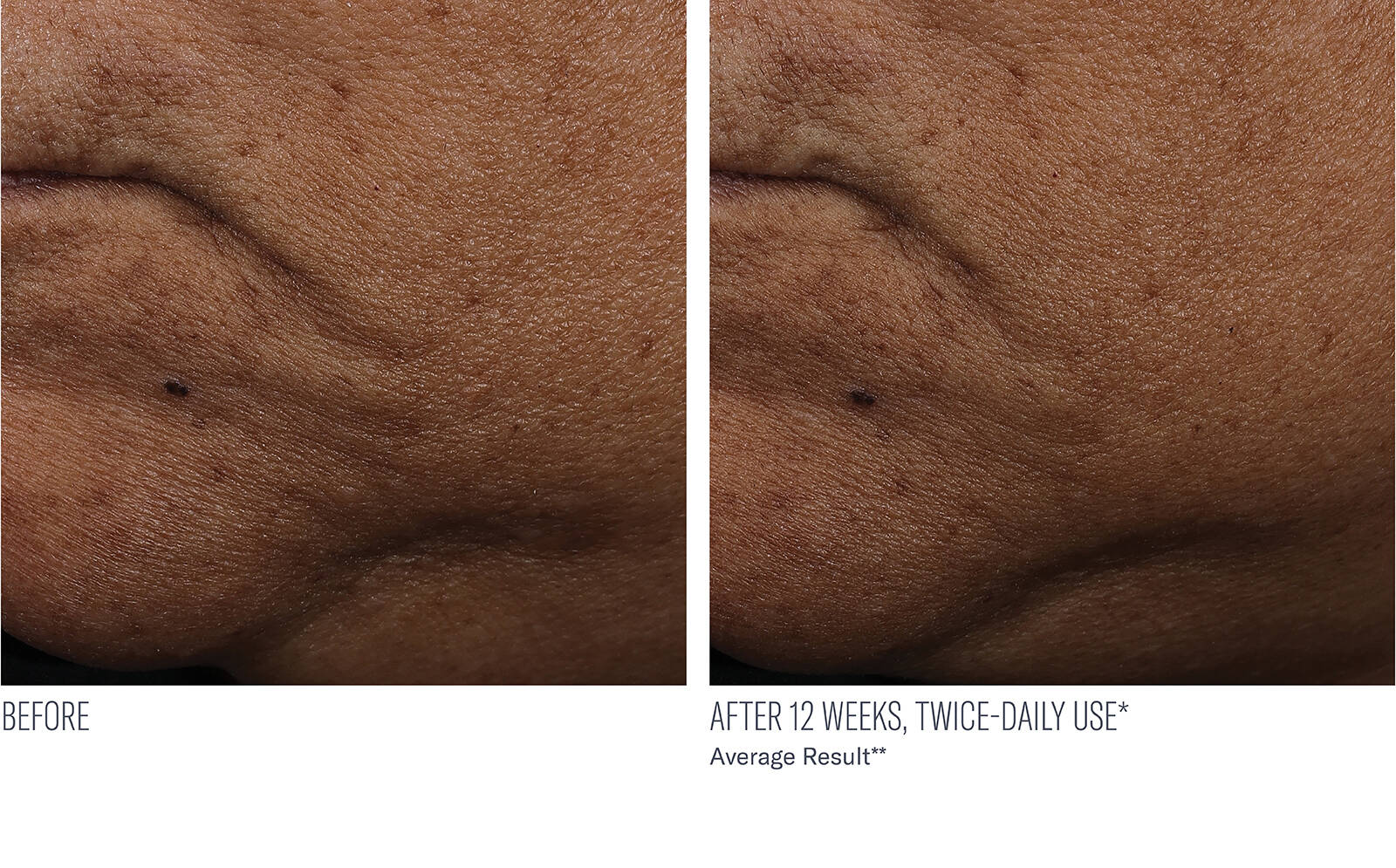 SkinBetter Science® InterFuse® Treatment Cream FACE & NECK