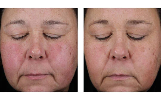 SkinBetter Science® Mystro Active Balance Serum™