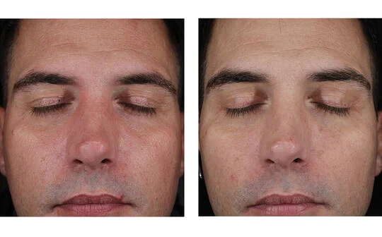 SkinBetter Science® Mystro Active Balance Serum™