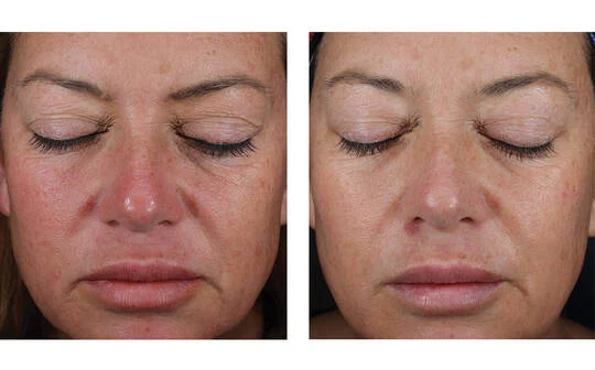SkinBetter Science® Mystro Active Balance Serum™