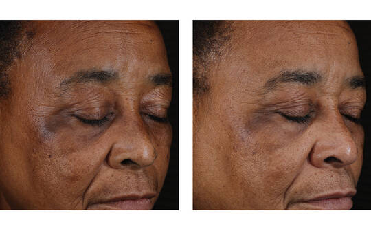 SkinBetter Science® Mystro Active Balance Serum™