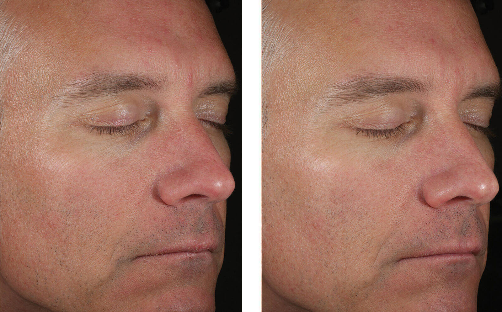SkinBetter Science® Solo Hydrating Defense™ MEN