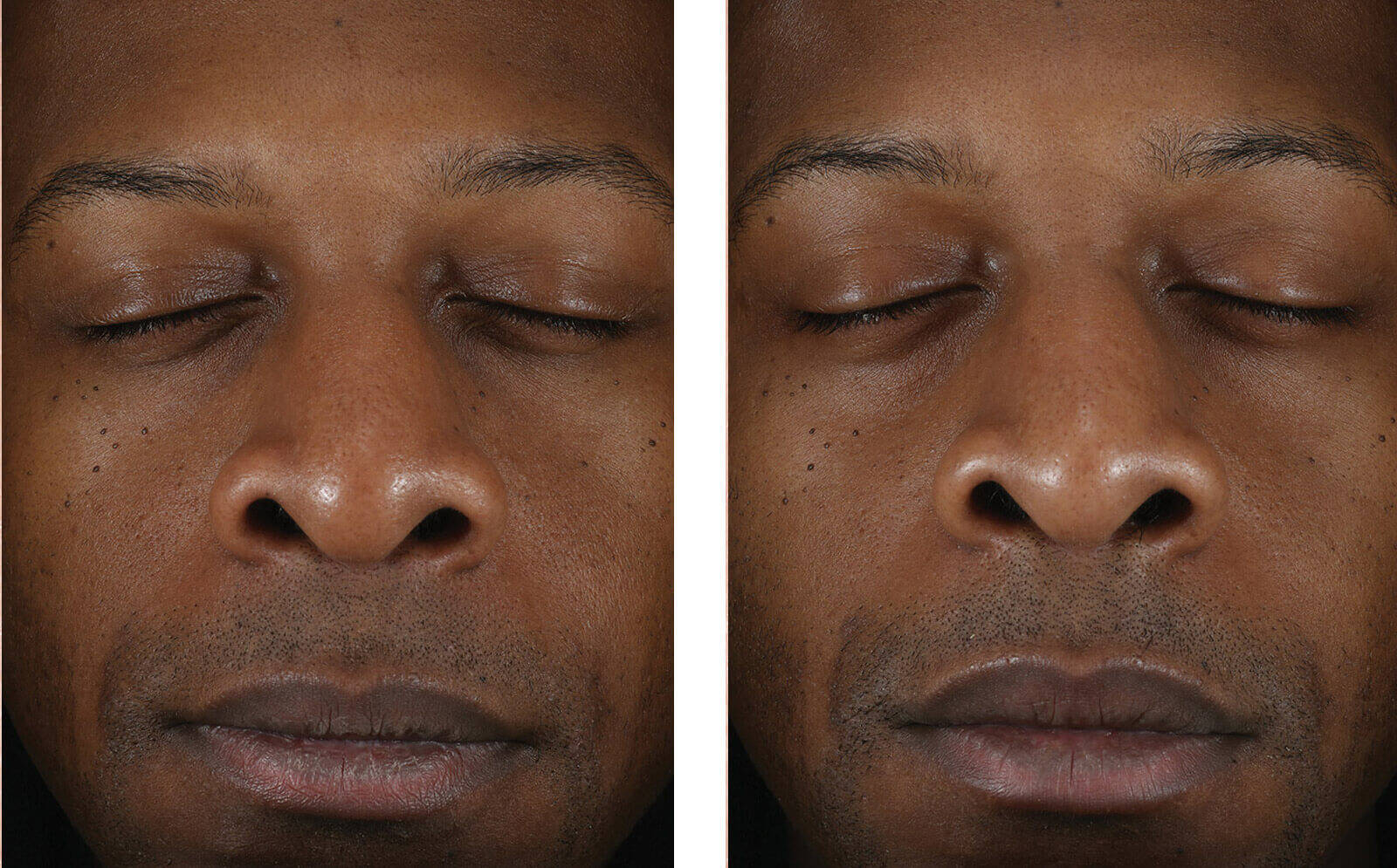 SkinBetter Science® Solo Hydrating Defense™ MEN