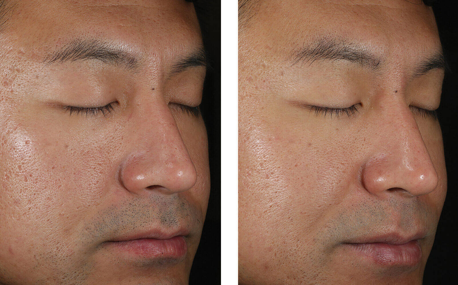 SkinBetter Science® Solo Hydrating Defense™ MEN