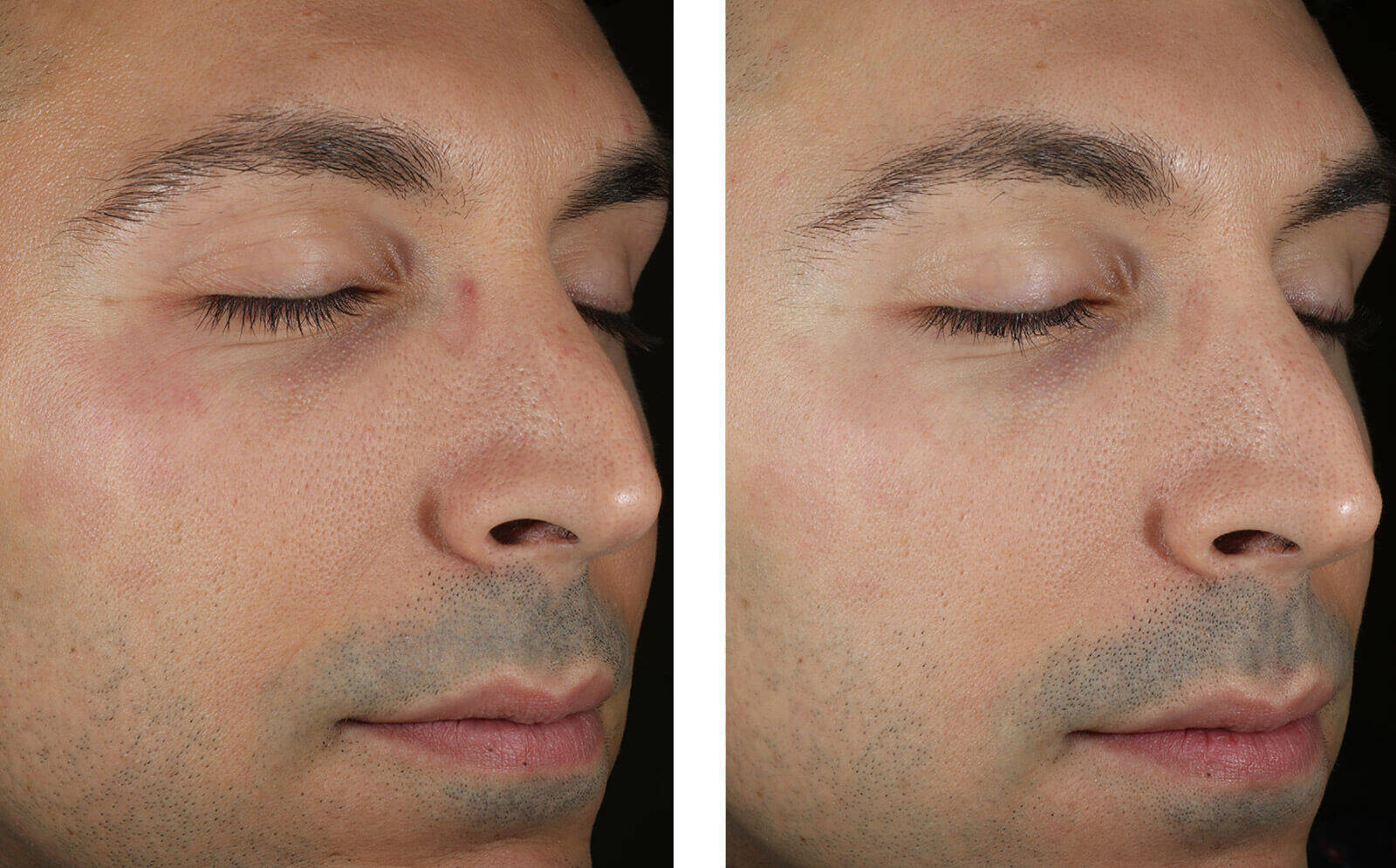 SkinBetter Science® Solo Hydrating Defense™ MEN