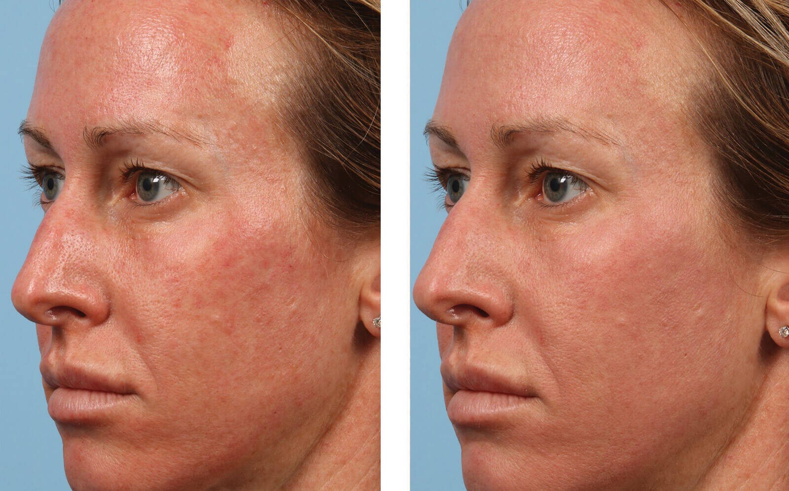 SkinBetter Science® Sunbetter® Tone Smart SPF 68 Sunscreen Compact