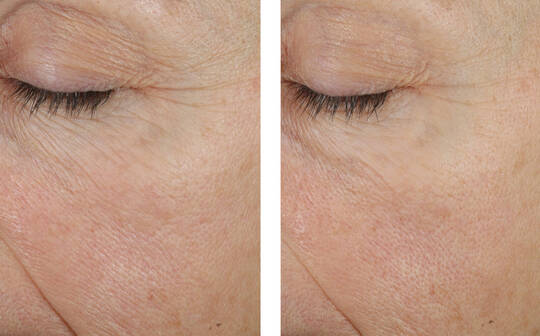 SkinBetter Science® Trio Rebalancing Moisture Treatment