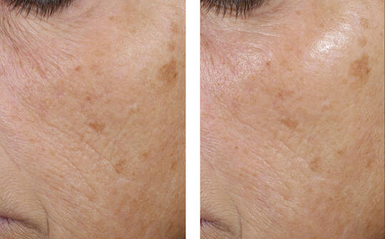 SkinBetter Science® Trio Rebalancing Moisture Treatment