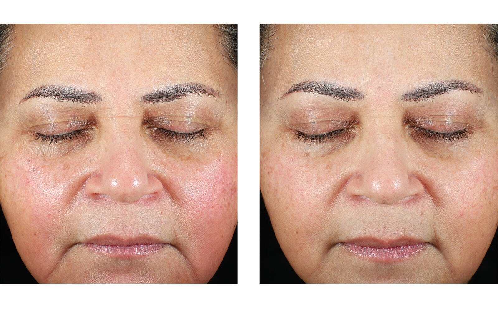 SkinBetter Science® Trio Luxe Moisture Treatment