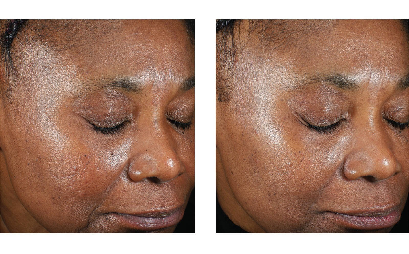 SkinBetter Science® Trio Luxe Moisture Treatment