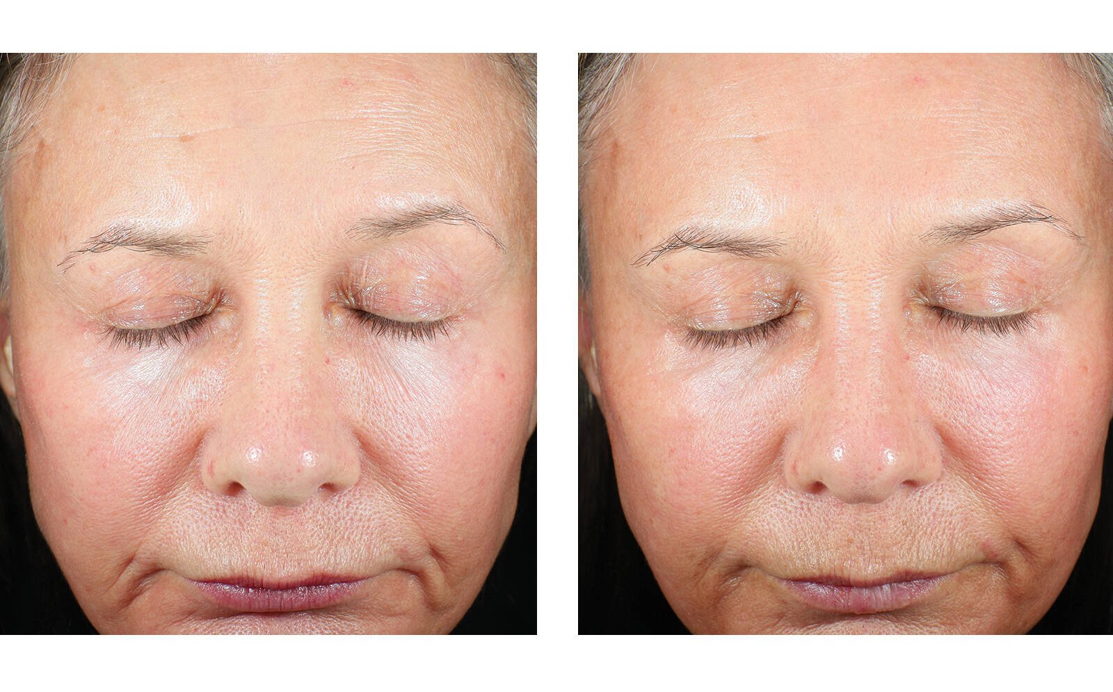 SkinBetter Science® Trio Luxe Moisture Treatment