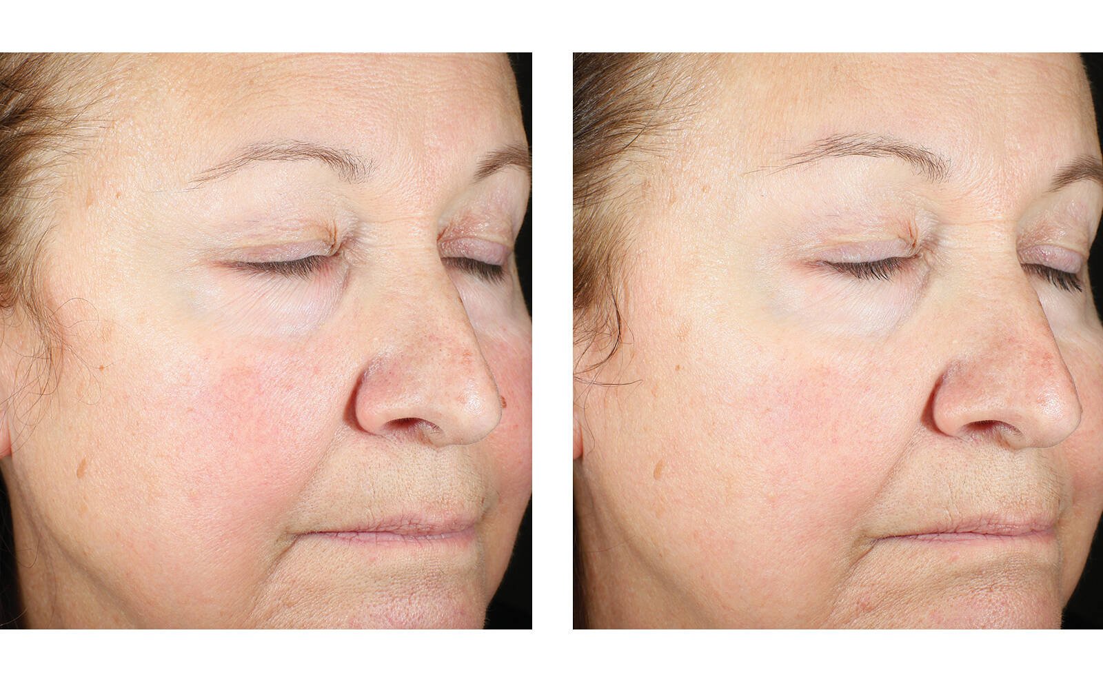 SkinBetter Science® Trio Luxe Moisture Treatment